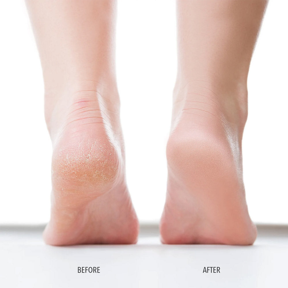 LondonTown Kur Pedikur Foot Scrub 118ml - esfoliante per piedi