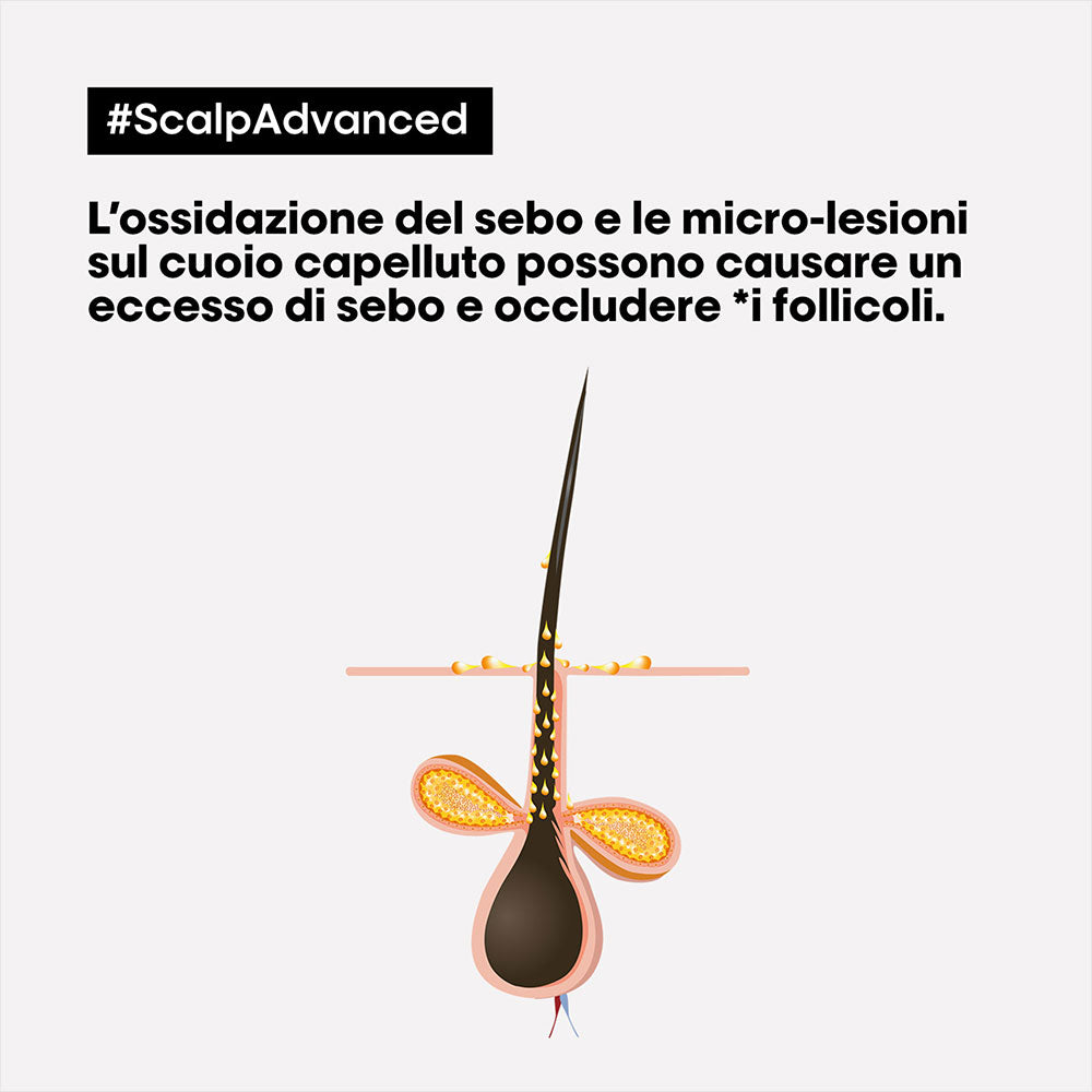 L'Oreal Professionnel Paris Scalp Advanced Anti-Oiliness Shampoo 500ml
