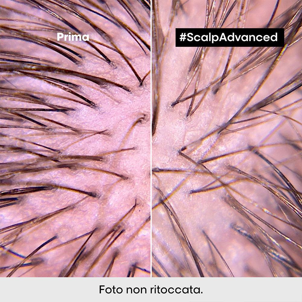 L'Oreal Professionel Scalp Advanced Anti-Discomfort Intense Soother 200ml