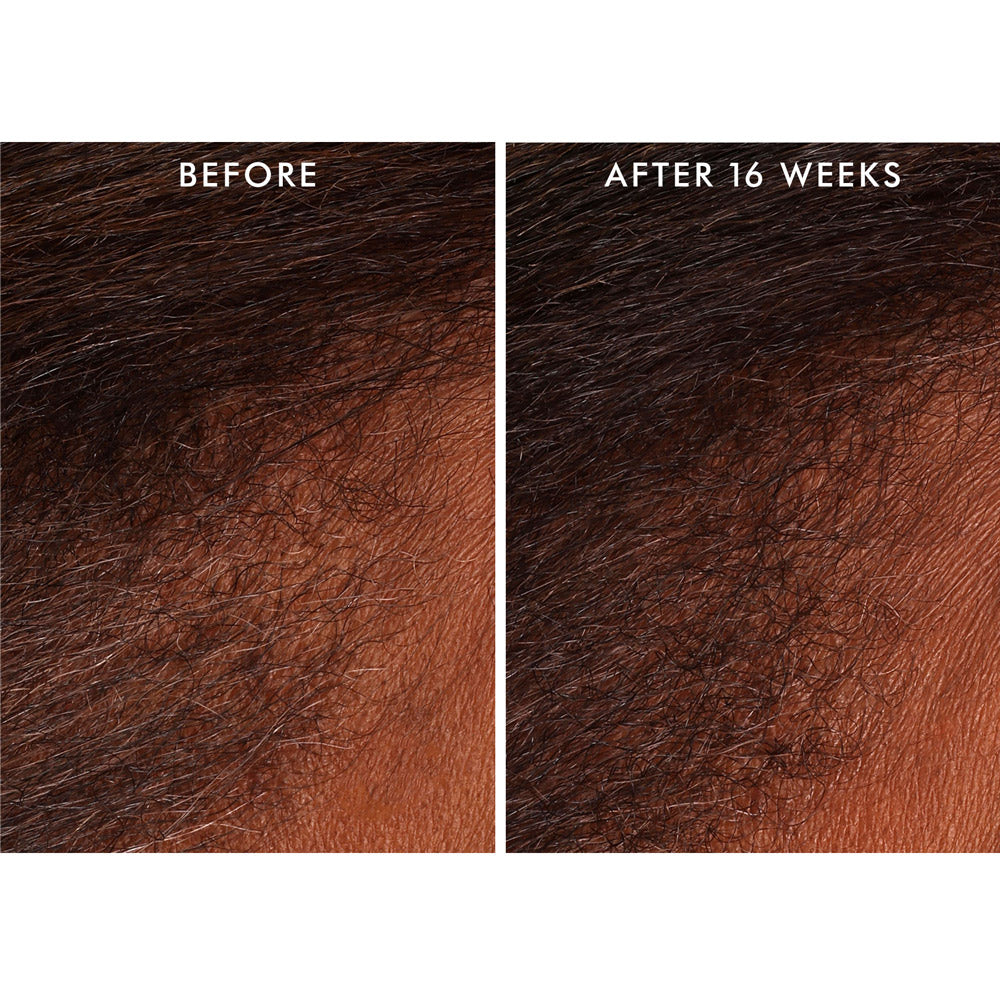 Moroccanoil Scalp Revitalizing Tonic Scalp 100ml - tonico rivitalizzante cuoio